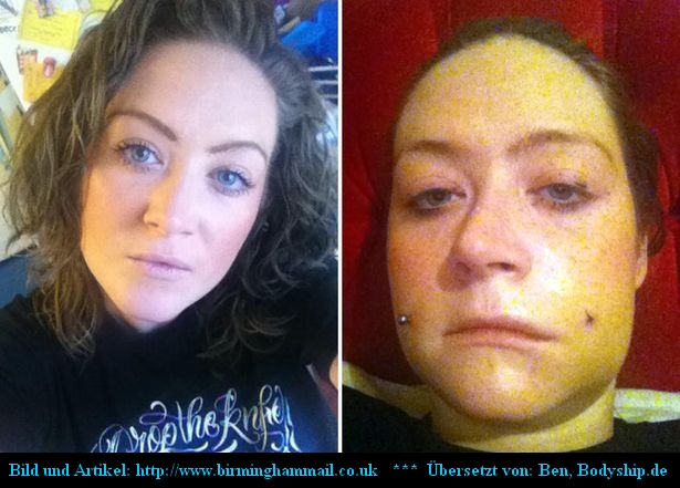 Cheek Unfall Arterie verletzt Artikel