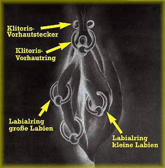 Bodyship.de-Piercing-und-Bodymodification-Halle---Intimpiercing-Bild-weiblich-frau