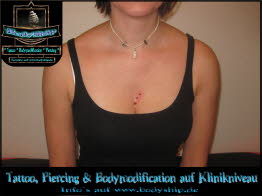 Drei 3 Implantate im Dekolette Brust Busen weiblich Dermal Anchor Microdermal Glitzer Piercing Bodymod by Bodyship Halle - Sachsen Anhalt - www