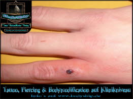 Finger weiblich Dermal Anchor Microdermal Glitzer Piercing Bodymod by Bodyship Halle - Sachsen Anhalt - www