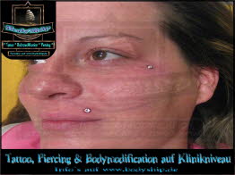  - db_am-Auge-in-der-Lippe-Madonna-Monroe-Ersatz-Skin-Face-weiblich-Dermal-Anchor-Microdermal-Glitzer-Piercing-Bodymod-by-Bodyship-Halle---Sachsen-Anhalt---www_bodyship_de-2